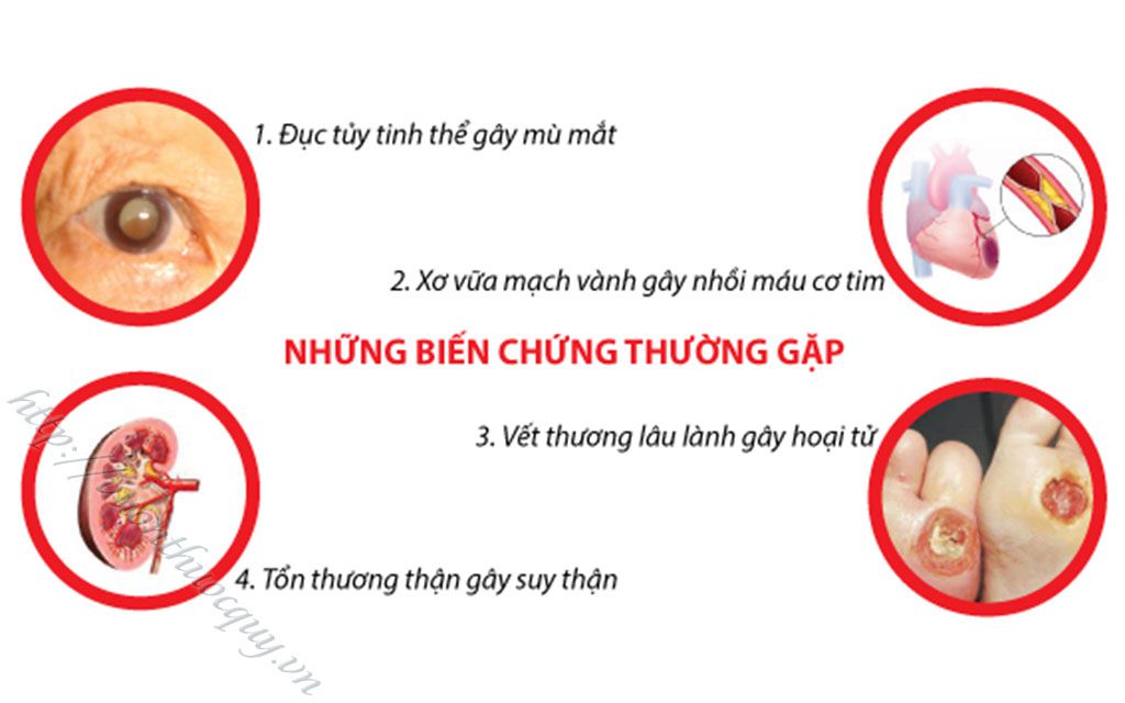 biến chứng của bệnh tiểu đường