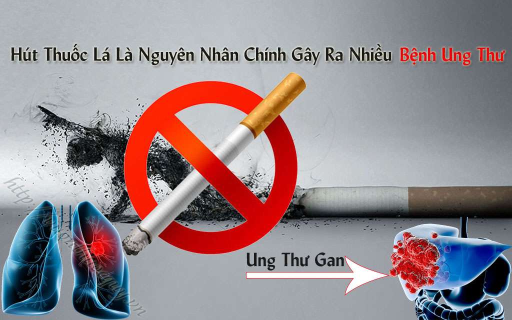 nguyên nhân gây ra bệnh ung thư