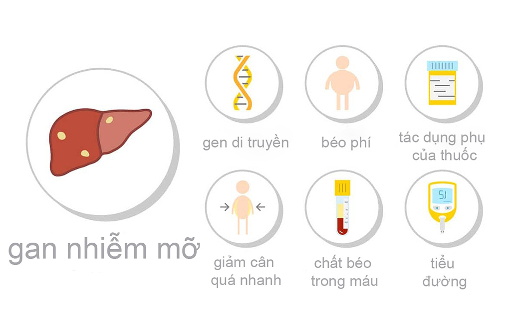 Nguyên Nhân Gây Ra Bệnh Gan Nhiễm Mỡ