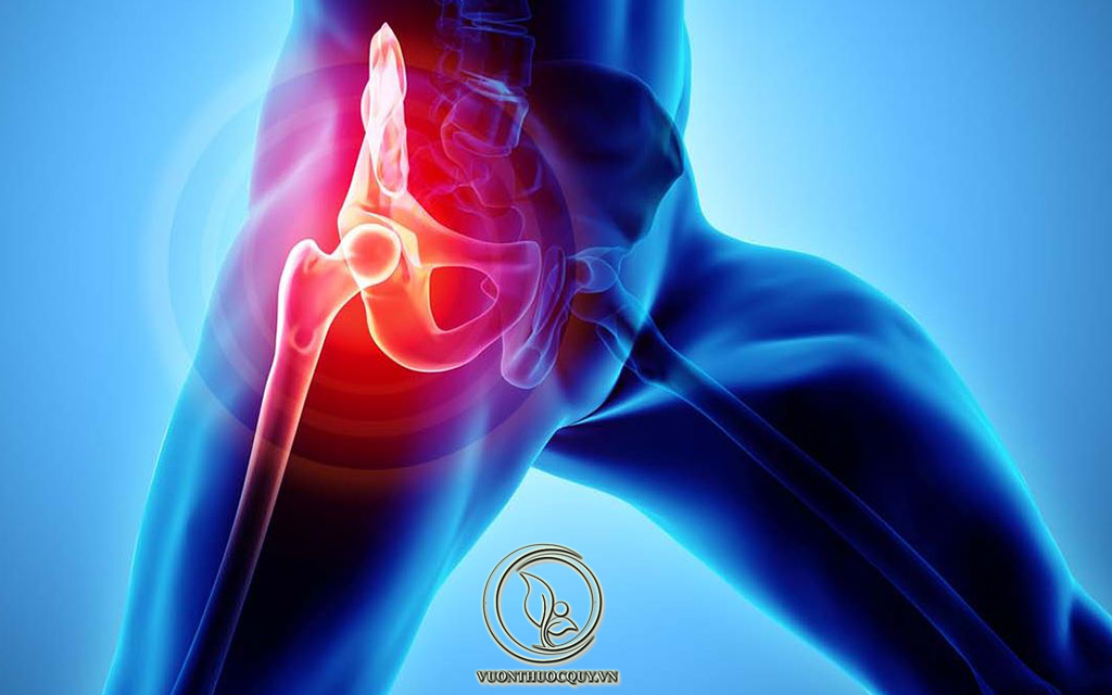 Nguyên Nhân Gây Ra Viêm Khớp