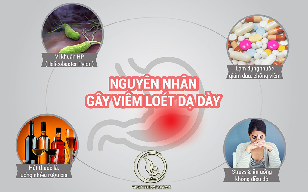 Nguyên Nhân Gây Ra Viêm Loét Dạ Dày