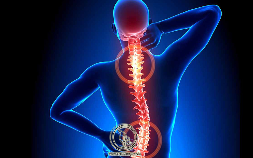 Bệnh Gai Cột Sống Có Chữa Khỏi Được Không ?