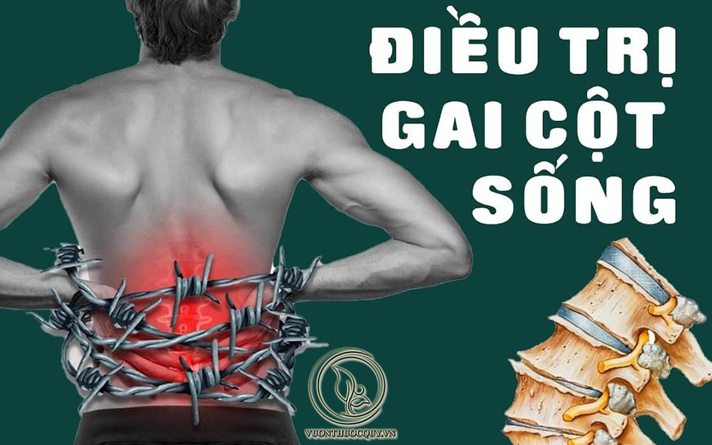 Bị Gai Cột Sống Có Nguy Hiểm Không ?