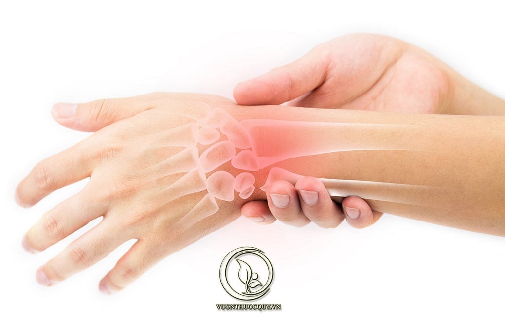 Biểu Hiện Khi Mắc Hội Chứng Cổ Vai Cánh Tay