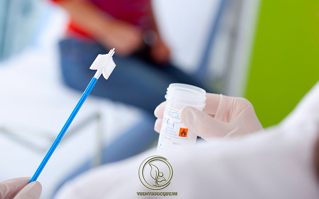 Cách Chữa Viêm Niệu Đạo Tại Nhà