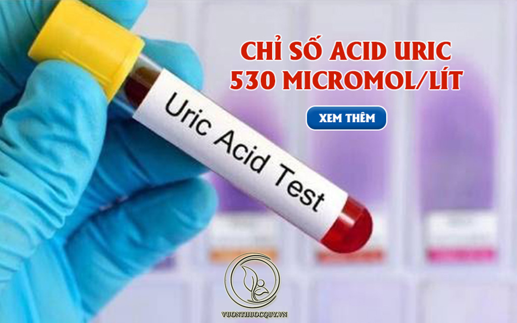 Chỉ Số Acid Uric 530 Là Cao Hay Thấp