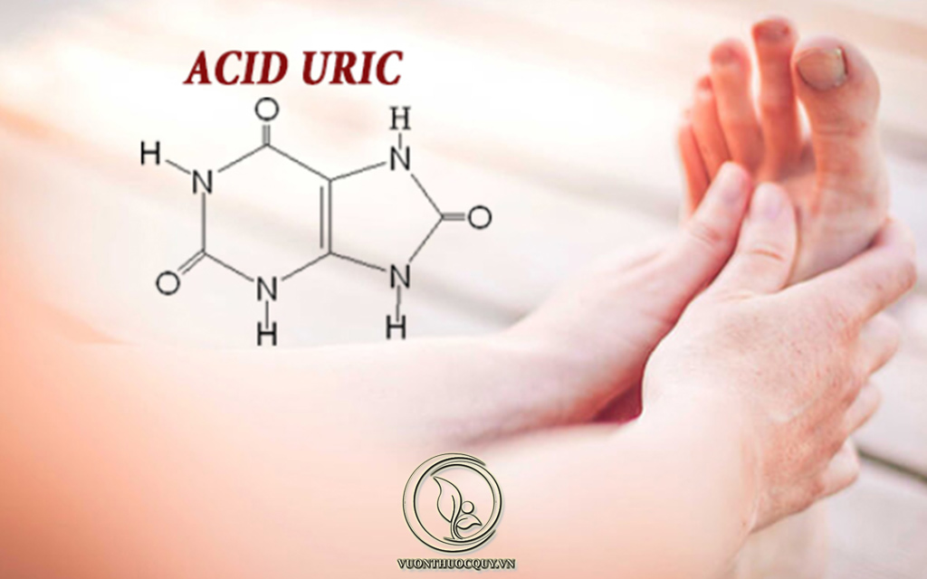 Những Biện Pháp Giúp Hạ Acid Uric Máu Cho Người Bệnh Gout