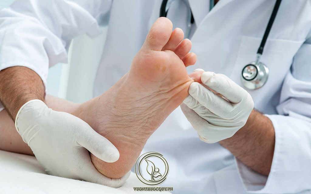 Bệnh Tổ Đỉa Có Chữa Khỏi Được Không ?